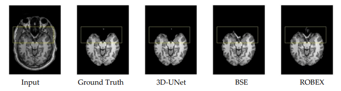 mri1