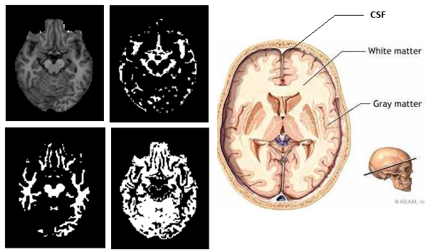 mri2