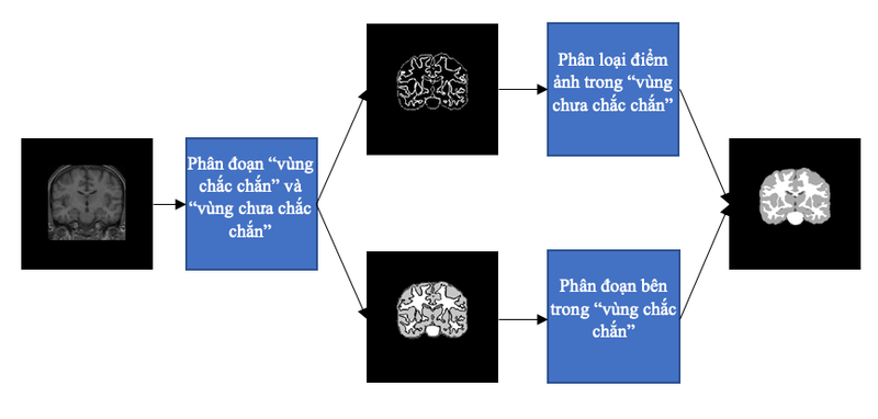 mri3