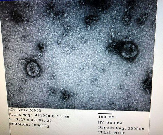 coronopl